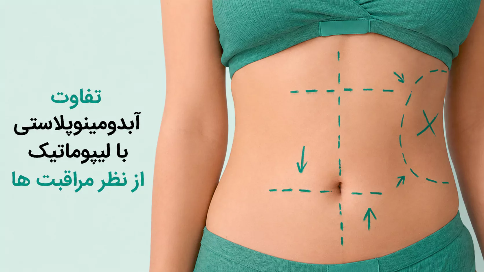 تفاوت ابدومینوپلاستی با لیپوماتیک از نظر مراقبت‌ها
