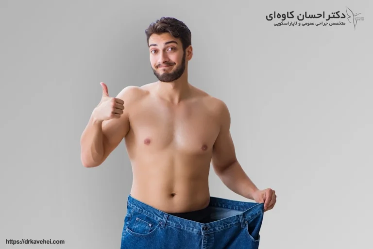 عوارض اسلیو معده