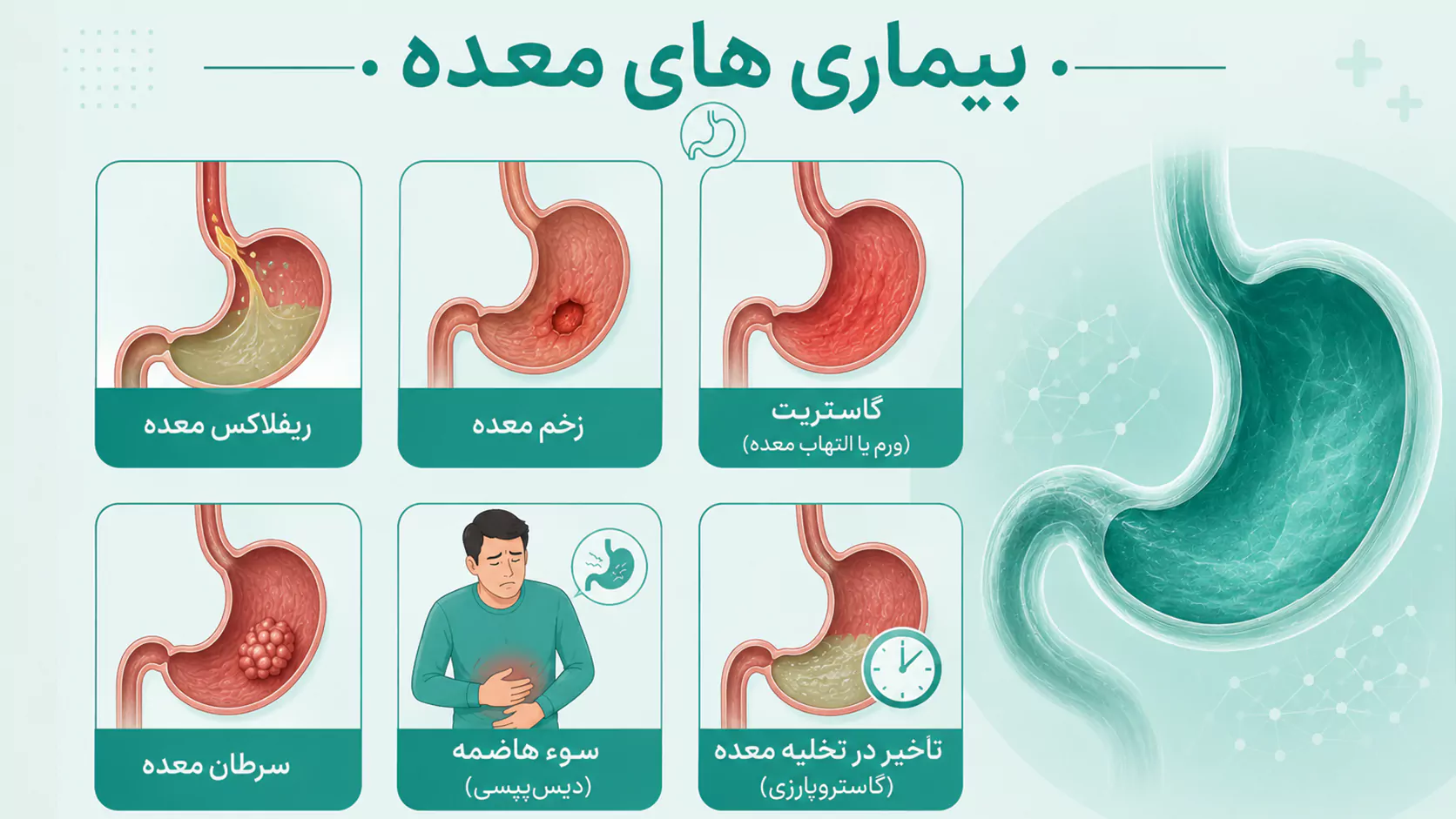 بیماری های معده