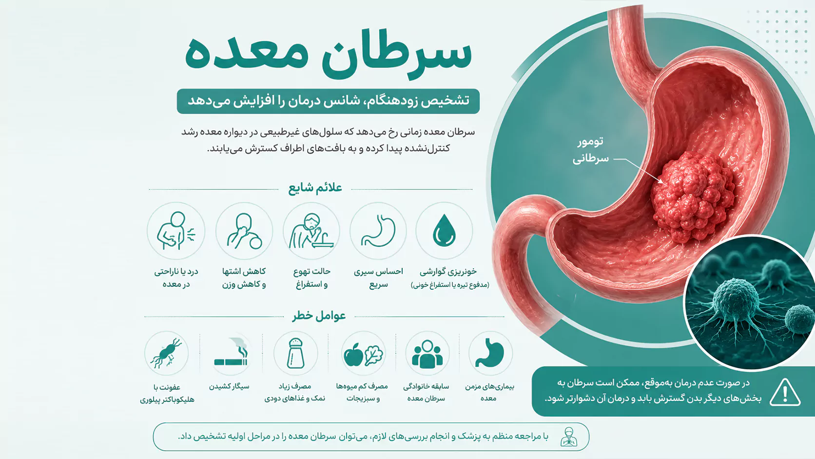 سرطان معده