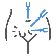 جراحی انواع هرنی