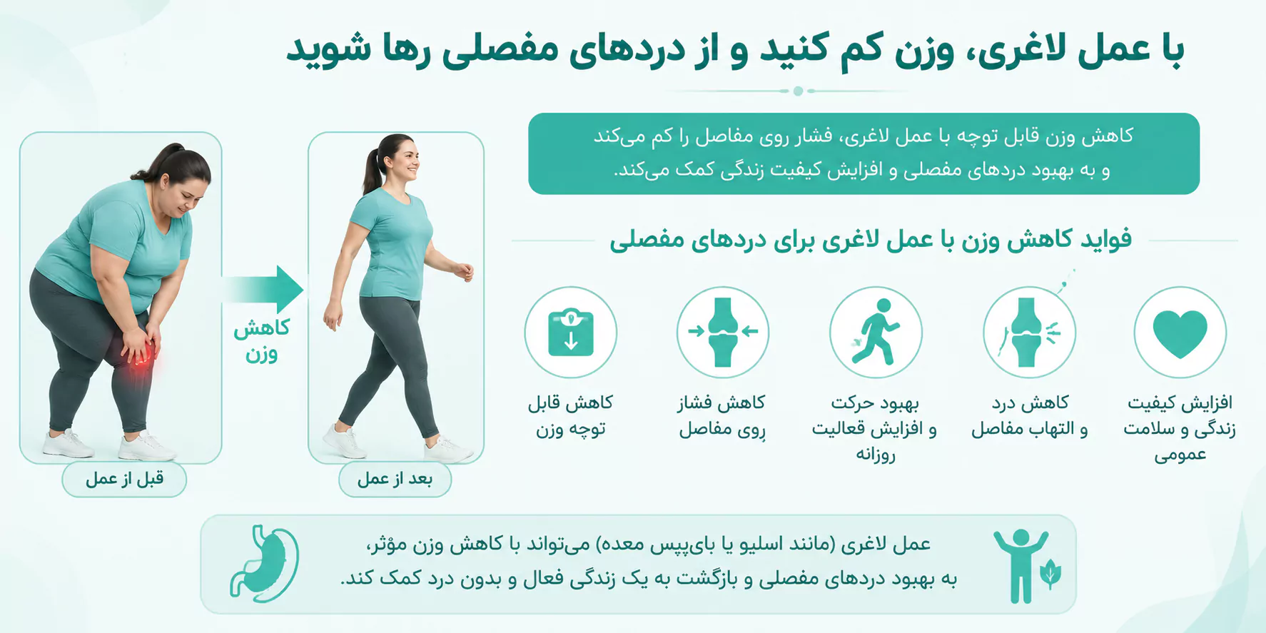 برای درمان بیماری های مفصلی چه زمانی به عمل لاغری نیاز است